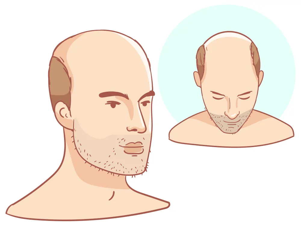 Bald