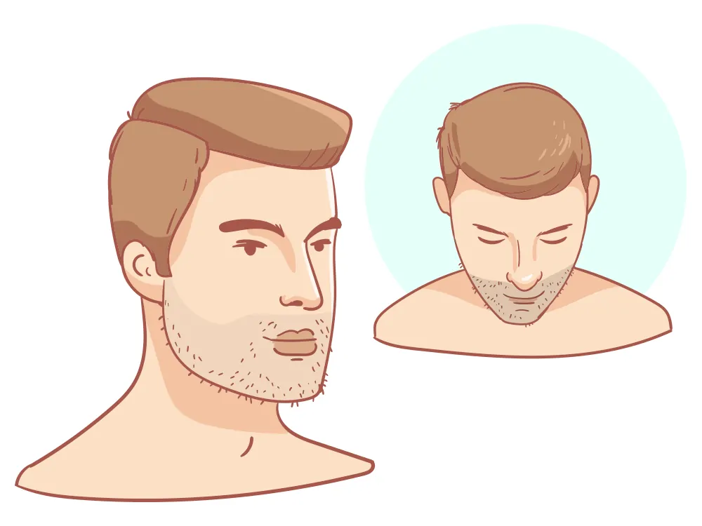 No hair loss
